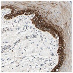MANSC1 Rabbit anti-Human, Polyclonal Antibody, Abnova 100&mu;L; Unlabeled:Antibodies,