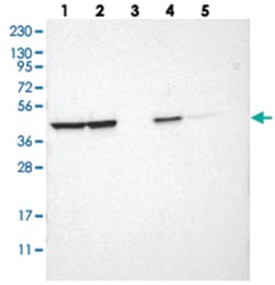 LRPAP1, Rabbit, Polyclonal Antibody, Abnova 100 &mu;L | Buy Online | Abnova Corporation | Fisher Scientific