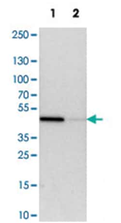 LRPAP1, Rabbit, Polyclonal Antibody, Abnova 100 &mu;L | Buy Online | Abnova Corporation | Fisher Scientific