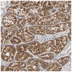 LRPAP1, Rabbit, Polyclonal Antibody, Abnova 100 &mu;L | Buy Online | Abnova Corporation | Fisher Scientific