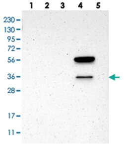 LY6G6F, Rabbit, Polyclonal Antibody, Abnova 100&mu;L; Unlabeled:Antibodies,