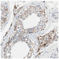 LY6G6F, Rabbit, Polyclonal Antibody, Abnova 100&mu;L; Unlabeled:Antibodies,