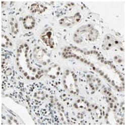 RNF43, Rabbit, Polyclonal Antibody, Abnova 100&mu;L; Unlabeled:Antibodies,