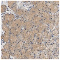C9orf46, Rabbit, Polyclonal Antibody, Abnova 100&mu;L; Unlabeled:Antibodies,
