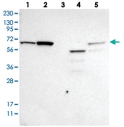 ME2 Rabbit anti-Human, Polyclonal Antibody, Abnova 100 &mu;L | Buy Online | Abnova Corporation | Fisher Scientific