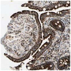 ME2 Rabbit anti-Human, Polyclonal Antibody, Abnova 100 &mu;L | Buy Online | Abnova Corporation | Fisher Scientific