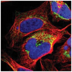 ME2 Rabbit anti-Human, Polyclonal Antibody, Abnova 100 &mu;L | Buy Online | Abnova Corporation | Fisher Scientific