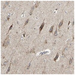 ANKS6, Rabbit, Polyclonal Antibody, Abnova 100 &mu;L | Buy Online | Abnova Corporation | Fisher Scientific