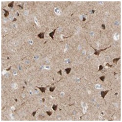 GRIA2 Rabbit anti-Human, Polyclonal Antibody, Abnova 100 &mu;L | Buy Online | Abnova Corporation | Fisher Scientific