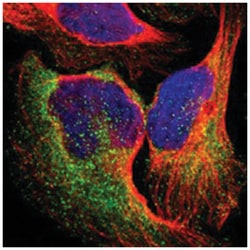 EPS15 Rabbit anti-Human, Polyclonal Antibody, Abnova 100&mu;L; Unlabeled:Antibodies,