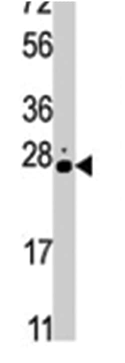 STK19, Rabbit, Polyclonal Antibody, Abnova 400&mu;L; Unlabeled:Antibodies,