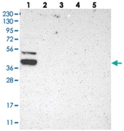 KLHDC8B Rabbit anti-Human, Polyclonal Antibody, Abnova 100 &mu;L | Buy Online | Abnova Corporation | Fisher Scientific