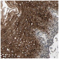 CCDC23, Rabbit, Polyclonal Antibody, Abnova 100&mu;L; Unlabeled:Antibodies,