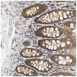LRRC47 Rabbit anti-Human, Polyclonal Antibody, Abnova 100 &mu;L | Buy Online | Abnova | Fisher Scientific