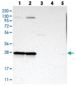 MRPL9 Rabbit anti-Human, Polyclonal Antibody, Abnova 100&mu;L; Unlabeled:Antibodies,