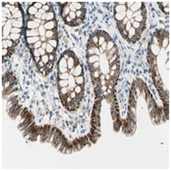 SLC6A15, Rabbit, Polyclonal Antibody, Abnova 100&mu;L; Unlabeled:Antibodies,