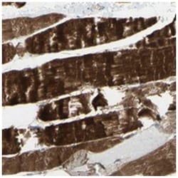 CACNA2D1 Rabbit anti-Human, Polyclonal Antibody, Abnova 100 &mu;L | Buy Online | Abnova Corporation | Fisher Scientific