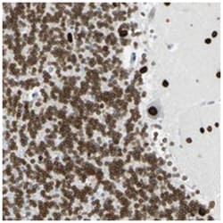 ZNF132, Rabbit, Polyclonal Antibody, Abnova 100&mu;L; Unlabeled:Antibodies,