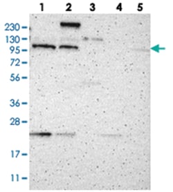 TMF1, Rabbit, Polyclonal Antibody, Abnova 100&mu;L; Unlabeled:Antibodies,
