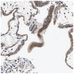 TMF1, Rabbit, Polyclonal Antibody, Abnova 100&mu;L; Unlabeled:Antibodies,