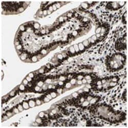 SFRS11, Rabbit, Polyclonal Antibody, Abnova 100&mu;L; Unlabeled:Antibodies,