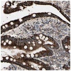 TMEM176A, Rabbit, Polyclonal Antibody, Abnova 100 &mu;L | Buy Online | Abnova Corporation | Fisher Scientific