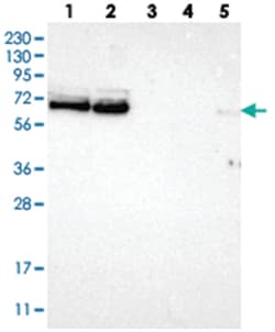 FUS Rabbit anti-Human, Mouse, Rat, Polyclonal Antibody, Abnova 100 &mu;L | Buy Online | Abnova Corporation | Fisher Scientific