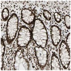 FUS Rabbit anti-Human, Mouse, Rat, Polyclonal Antibody, Abnova 100 &mu;L | Buy Online | Abnova Corporation | Fisher Scientific