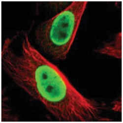 FUS Rabbit anti-Human, Mouse, Rat, Polyclonal Antibody, Abnova 100 &mu;L | Buy Online | Abnova Corporation | Fisher Scientific