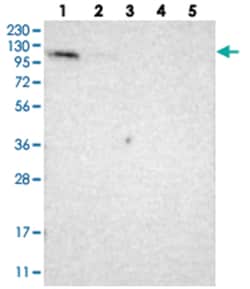 LONP2, Rabbit, Polyclonal Antibody, Abnova 100&mu;L; Unlabeled:Antibodies,