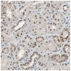 LONP2, Rabbit, Polyclonal Antibody, Abnova 100&mu;L; Unlabeled:Antibodies,