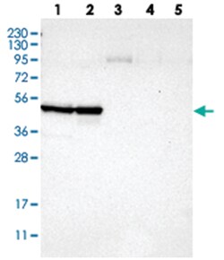 CCNB2, Rabbit, Polyclonal Antibody, Abnova 100&mu;L; Unlabeled:Antibodies,