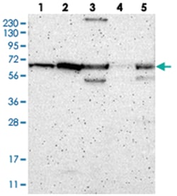 ME2 Rabbit anti-Human, Polyclonal Antibody, Abnova 100&mu;L; Unlabeled:Antibodies,