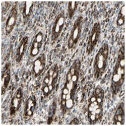 ME2 Rabbit anti-Human, Polyclonal Antibody, Abnova 100&mu;L; Unlabeled:Antibodies,