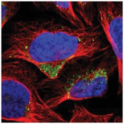 ME2 Rabbit anti-Human, Polyclonal Antibody, Abnova 100&mu;L; Unlabeled:Antibodies,