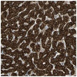 FLII Rabbit anti-Human, Mouse, Polyclonal Antibody, Abnova 100 &mu;L | Buy Online | Abnova Corporation | Fisher Scientific