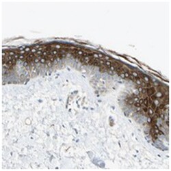 GPR125, Rabbit, Polyclonal Antibody, Abnova 100 &mu;L | Buy Online | Abnova Corporation | Fisher Scientific
