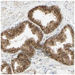 ENDOD1 Rabbit anti-Human, Polyclonal Antibody, Abnova 100 &mu;L | Buy Online | Abnova | Fisher Scientific