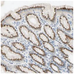 GALNT5 Rabbit anti-Human, Polyclonal Antibody, Abnova 100 &mu;L | Buy Online | Abnova Corporation | Fisher Scientific