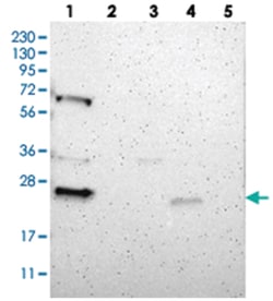 PRRG4 Rabbit anti-Human, Polyclonal Antibody, Abnova 100 &mu;L | Buy Online | Abnova Corporation | Fisher Scientific