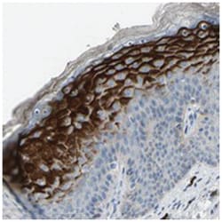 SPINK5 Rabbit anti-Human, Polyclonal Antibody, Abnova 100&mu;L; Unlabeled:Antibodies,