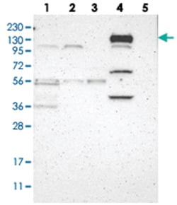 C20orf26, Rabbit, Polyclonal Antibody, Abnova 100 &mu;L | Buy Online | Abnova Corporation | Fisher Scientific