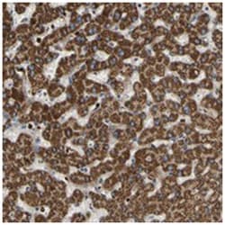 C20orf26, Rabbit, Polyclonal Antibody, Abnova 100 &mu;L | Buy Online | Abnova Corporation | Fisher Scientific