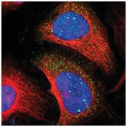 LHPP Rabbit anti-Human, Polyclonal Antibody, Abnova 100&mu;L; Unlabeled:Antibodies,