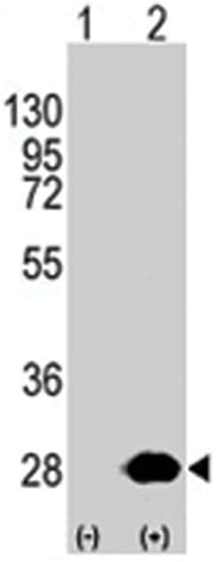 HSPB1 Rabbit anti-Human, Polyclonal Antibody, Abnova 400&mu;L; Unlabeled:Antibodies,