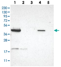 GRAMD3 Rabbit anti-Human, Polyclonal Antibody, Abnova 100 &mu;L | Buy Online | Abnova Corporation | Fisher Scientific