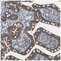 GRAMD3 Rabbit anti-Human, Polyclonal Antibody, Abnova 100 &mu;L | Buy Online | Abnova Corporation | Fisher Scientific