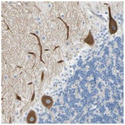 FRMD4B, Rabbit, Polyclonal Antibody, Abnova 100&mu;L; Unlabeled:Antibodies,