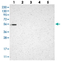 GMEB2, Rabbit, Polyclonal Antibody, Abnova 100&mu;L; Unlabeled:Antibodies,