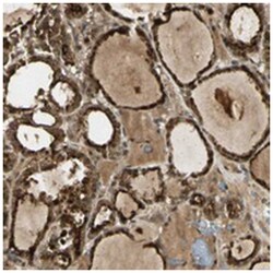 GMEB2, Rabbit, Polyclonal Antibody, Abnova 100&mu;L; Unlabeled:Antibodies,